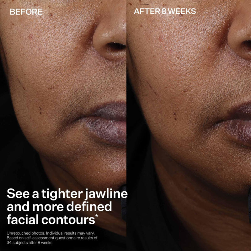 Sérum Strivectin Tighten And Lift Peptight 30 Ml Para Rosto - Image 6