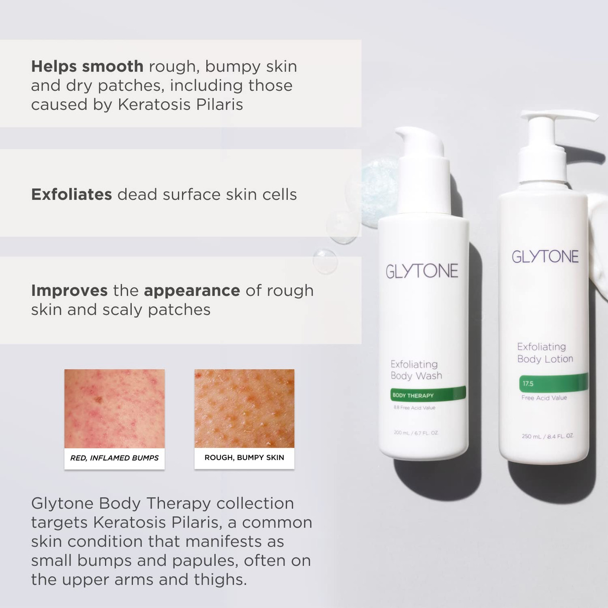 Loção Corporal Glytone Esfoliante 17,5% Ácido Glicólico 250m - Imagem 5
