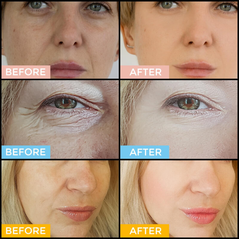 Conjunto De Cuidados Com A Pele Facial+1 Soro De Retinol Her - Image 5