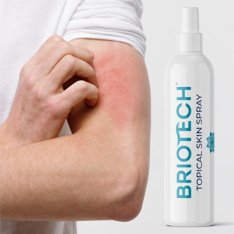 Spray De Pele Briotech Ácido Hipocloroso Tópico De 120 Ml, P - Image 6