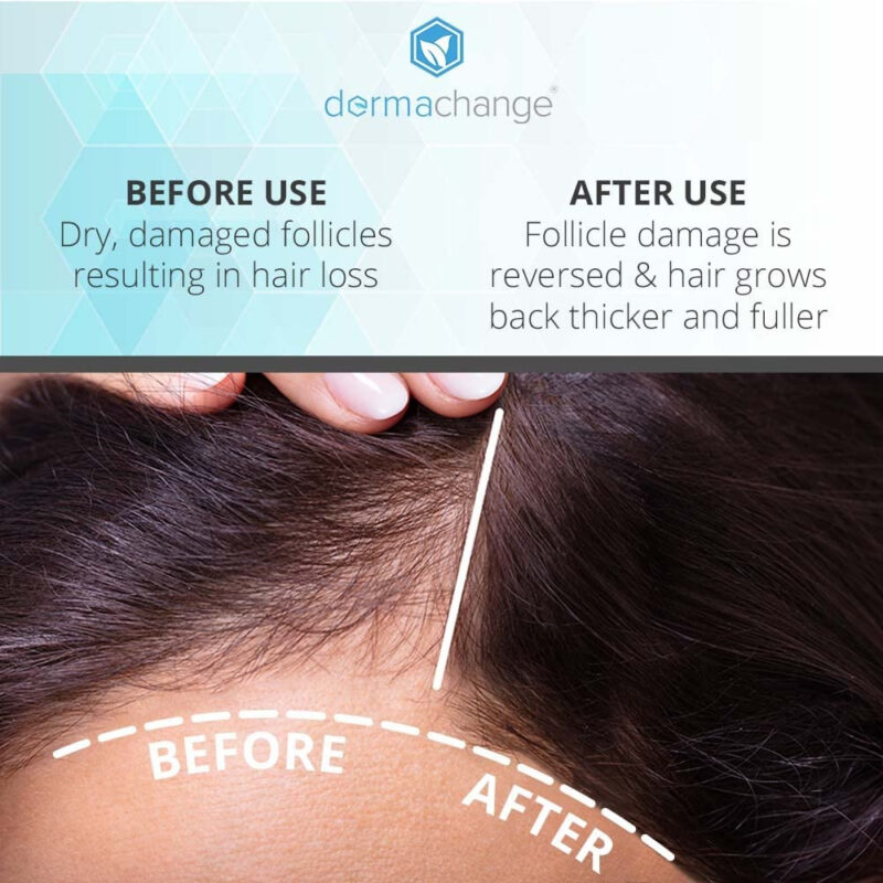 Shampoo Para Crescimento Capilar Dermachange Volumizing Sulf - Image 4