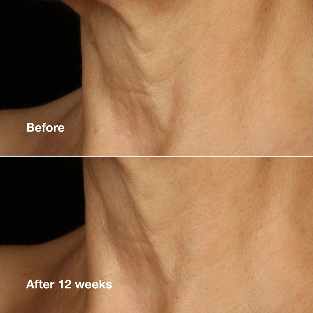 Creme Clinique Smart Clinique Clinique Clinique Lifting Face - Imagem 5