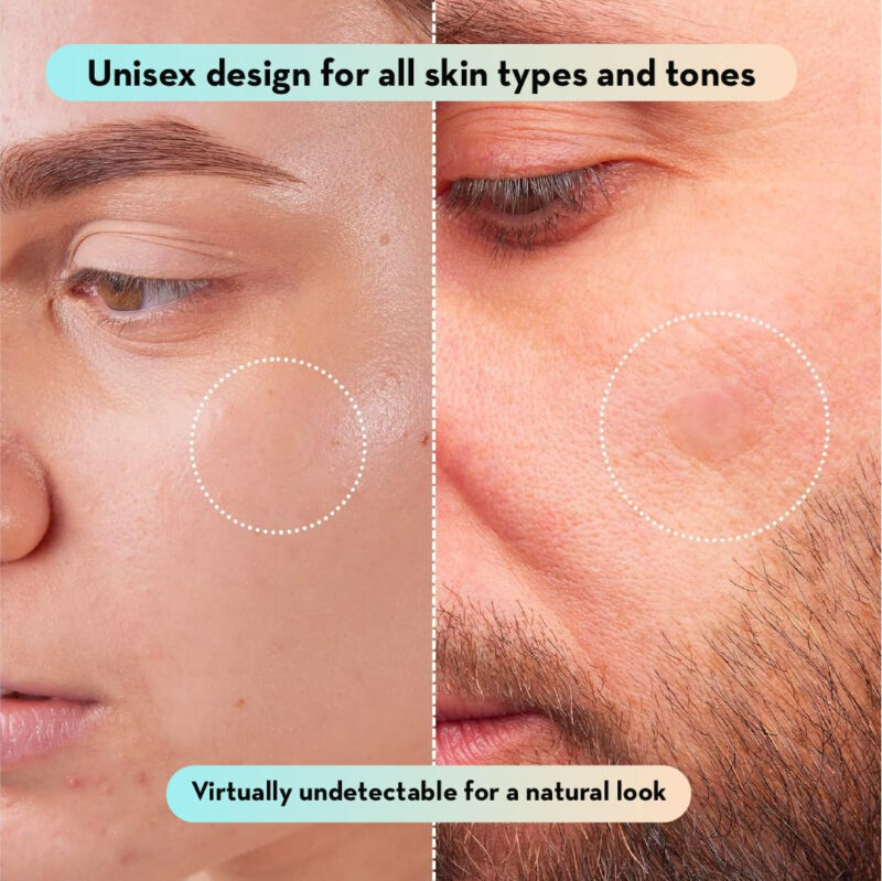 Adesivo Hidrocolóide Para Acne Le Gushe K-beauty Pimple Patc - Imagem 7