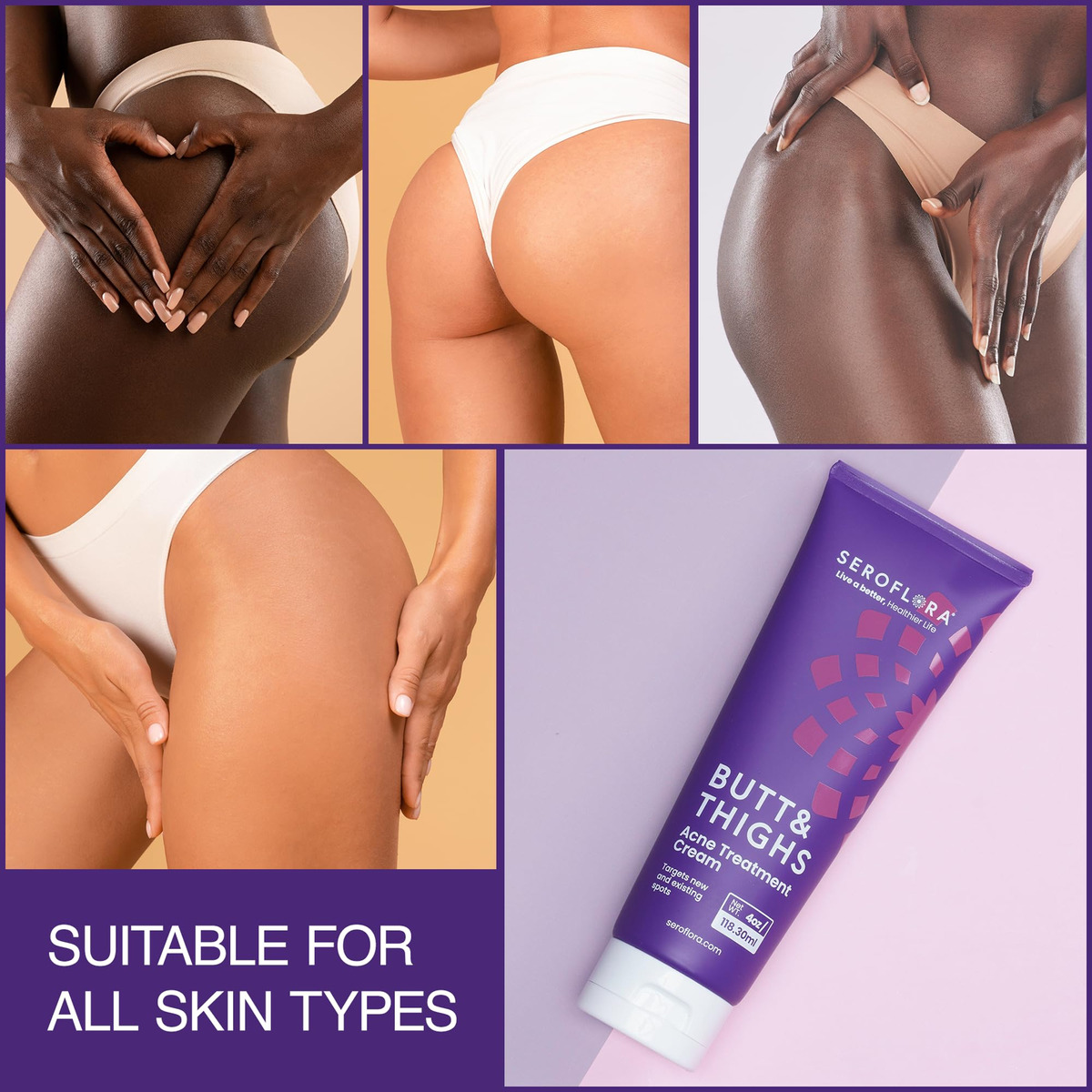 Creme De Tratamento Da Acne Seroflora Butt & Tighs 120ml - Imagem 5