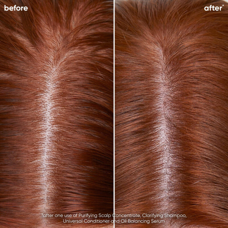 Shampoo Biolage Scalp Sync Clarifying Vegan Para Cabelos Ole - Image 3