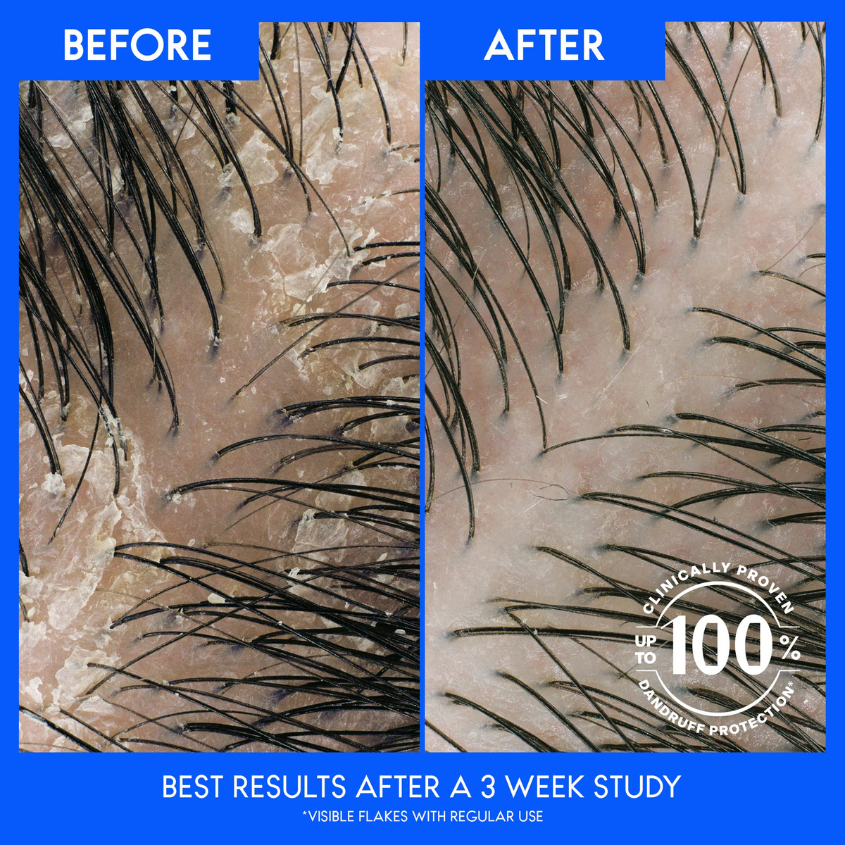 Shampoo E Condicionador Head & Shoulders 2 Em 1 Anticaspa - Imagem 5