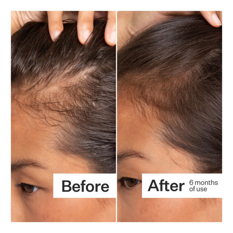 Scalp Serum Act+ Acre Células-tronco Processadas A Frio Para - Image 6