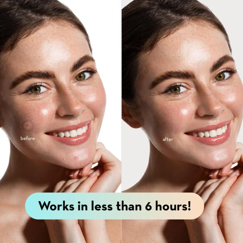 Adesivo Hidrocolóide Para Acne Le Gushe K-beauty Pimple Patc - Imagem 5