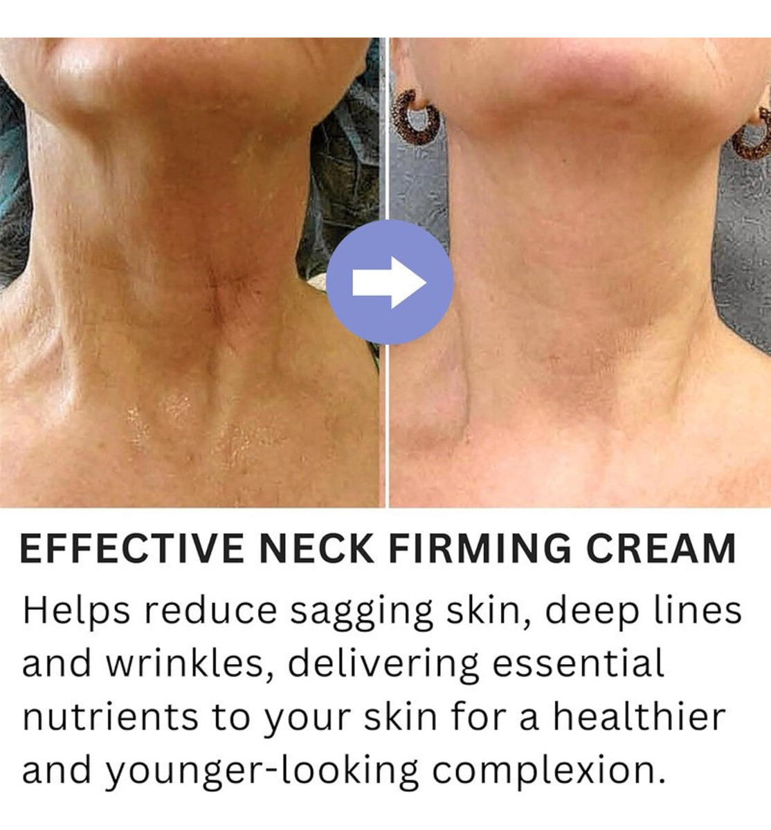Creme Reafirmante De Pescoço Sewog Hidratante Antirrugas 50m - Imagem 3