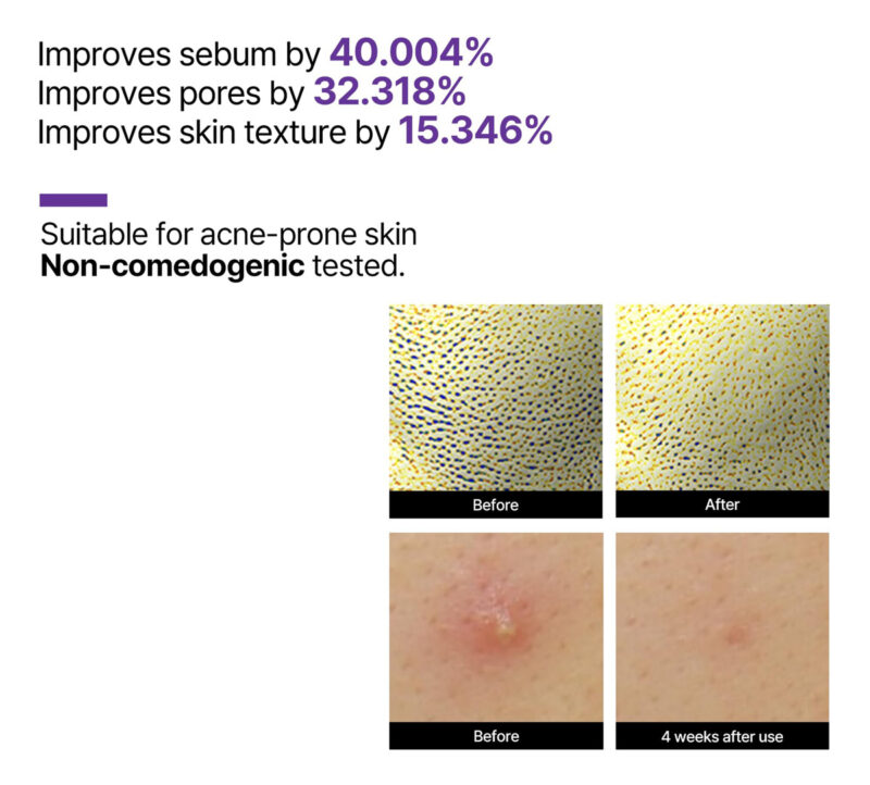 Sérum Some By Mi Retinol Intense Reativador 30 Ml Com 0,1% R - Image 5