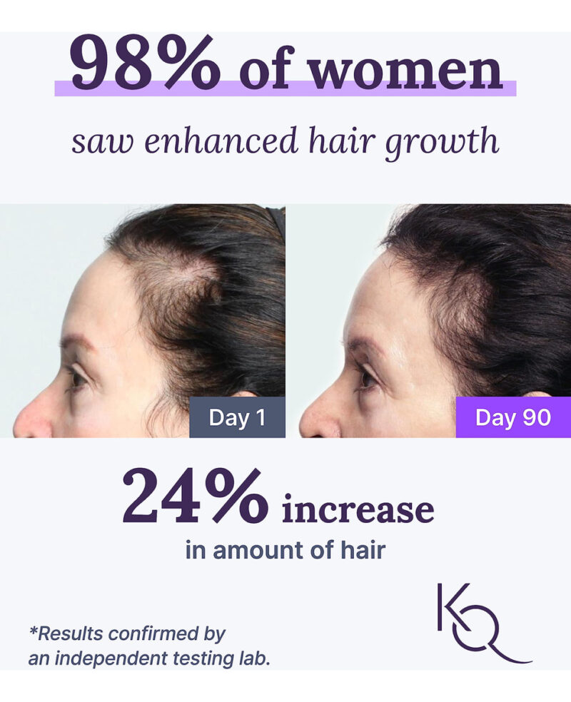 Suplemento Keranique Keraviatin Hair & Scalp Health 120 Soft - Image 2