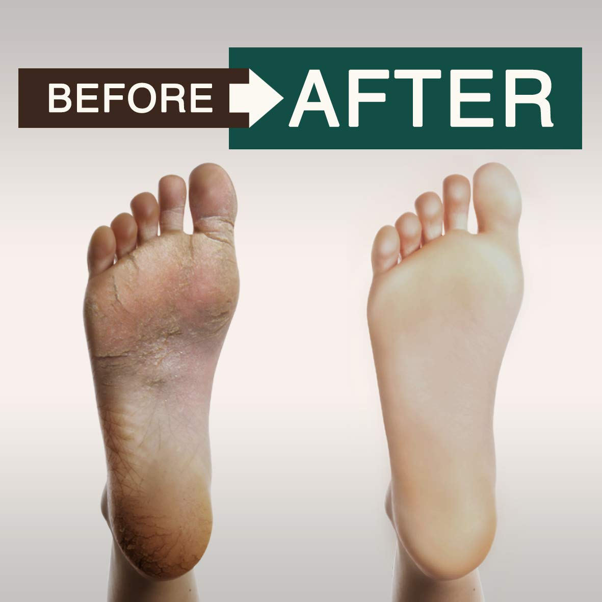 Sabonete Líquido Oriso Tea Tree Oil 480 Ml Ajuda A Acne Nos - Imagem 9