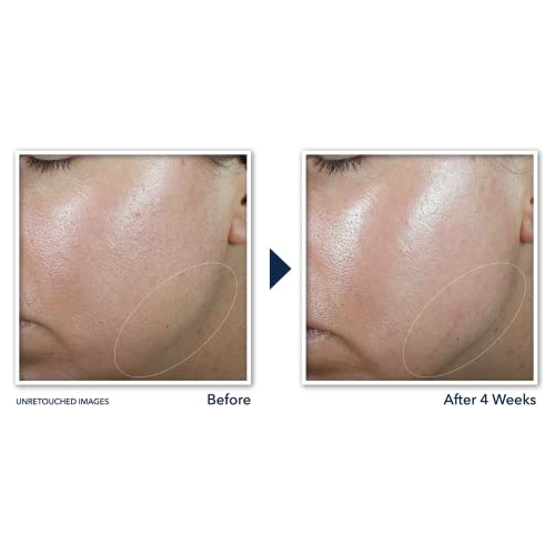 Creme De Pescoço Roc Lift & Tighten 1.198ml - Imagem 5