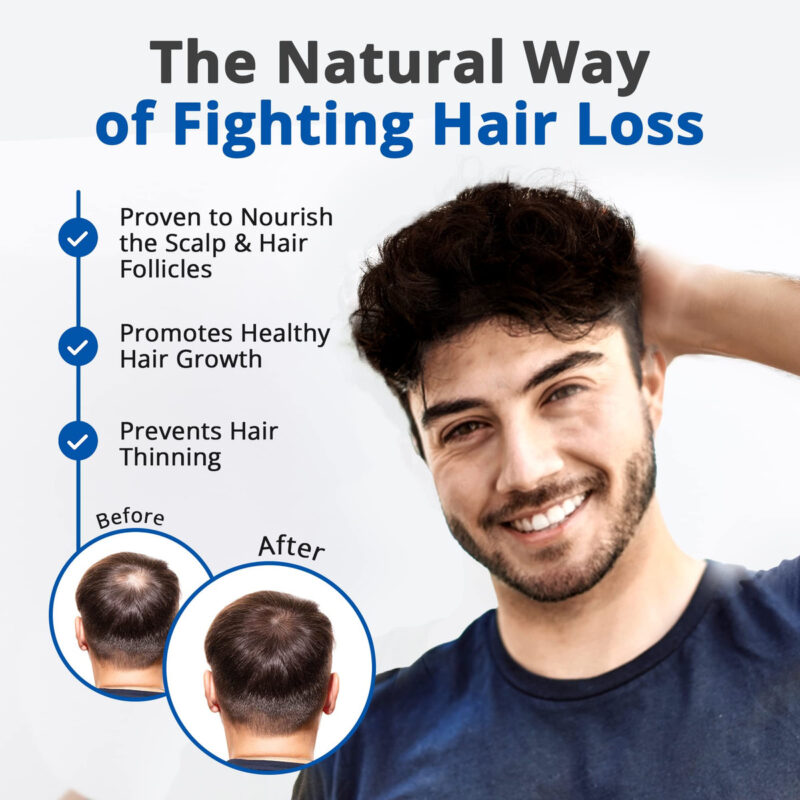 Sérum De Cabelo Hairmetto Para Queda E Crescimento De Cabelo - Image 3