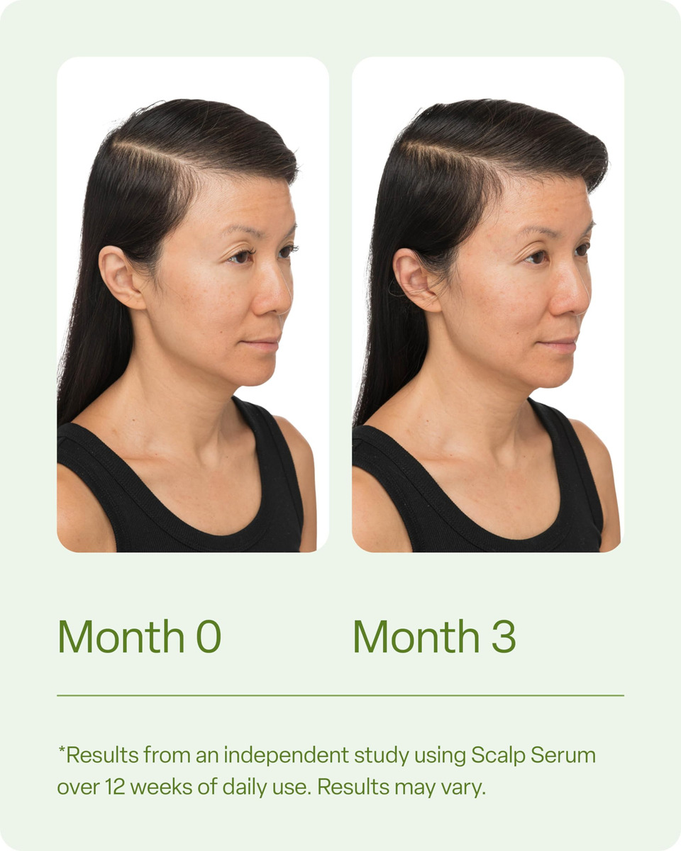 Pacote De Cuidados Com O Cabelo Divi Healthy Hair: Sérum Par - Imagem 4