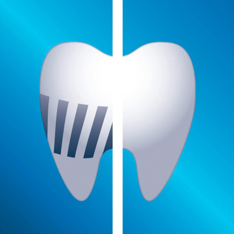 Cabeças De Escova De Dentes Philips Sonicare Proresults, Pac - Image 5