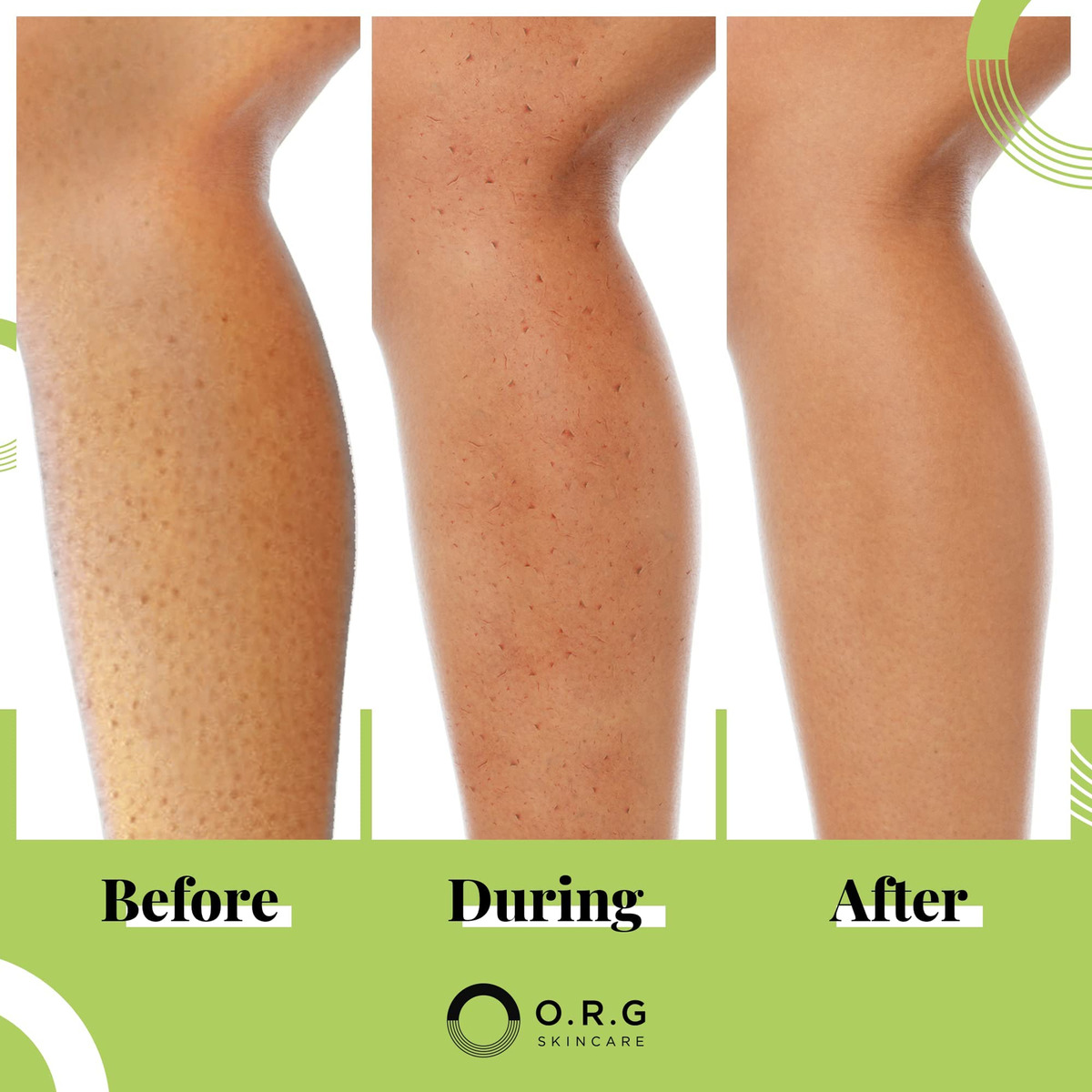 Esfoliante Em Gel Profundo Body Scrub O.r.g. Skincare 180ml - Imagem 6