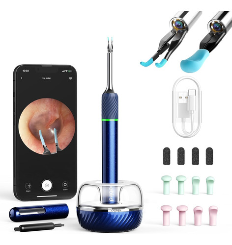 Ferramenta De Remoção De Cera De Ouvido Camera Bebird Note5