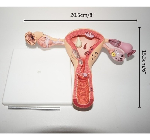 Modelo Anatômico De Ovário E Útero Com Patologias - Imagem 4