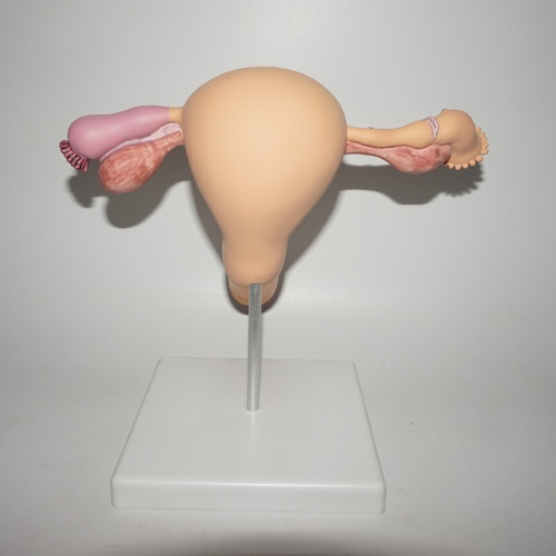 Modelo Anatômico De Ovário E Útero Com Patologias - Imagem 3