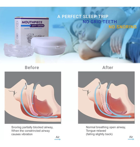 Novo Dispositivo Mouthguard Night Anti Ronco Grinding Time - Imagem 4