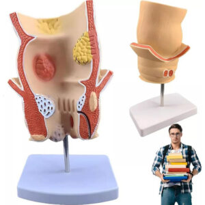 Modelo Retal Patológico Humano, Modelo De Reto Com Lesão De