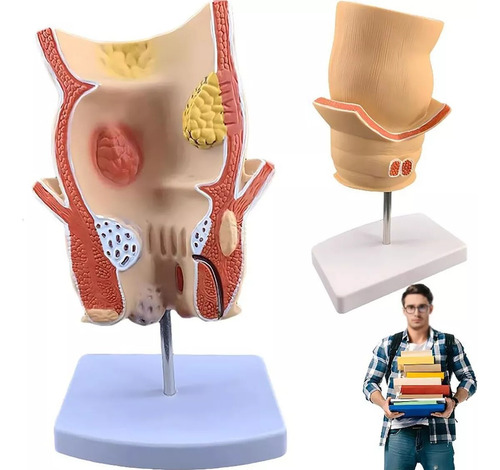 Modelo Retal Patológico Humano, Modelo De Reto Com Lesão De