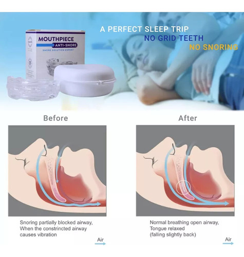 Novo Dispositivo Mouthguard Night Anti Ronco - Imagem 4