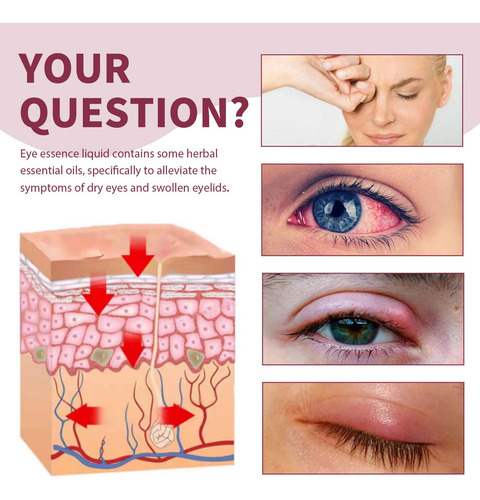 . Suero Para Olhos Calmante Contra Orzuelos Para Blefarite E - Imagem 4