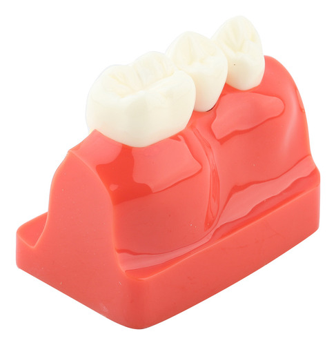 Análise De Implante De Modelo Dentário De Demonstração Dentá - Imagem 5