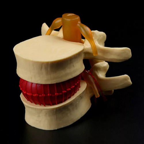Modelo De Vértebra Lombar: Disco Herniado Anatômico Da Colun - Imagem 7