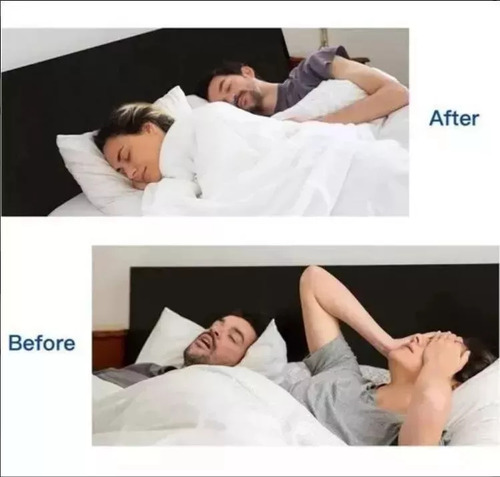 Formiga De Ronco Eletrônico Para Apneia Do Sono Cpap Aa - Imagem 3