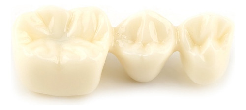 Análise De Implante De Modelo Dentário De Demonstração Dentá - Imagem 8