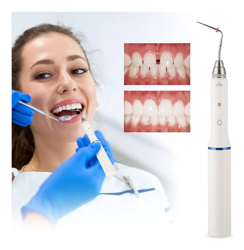 * Cortador De Guta-percha Dental Cortador De Borracha - Imagem 3