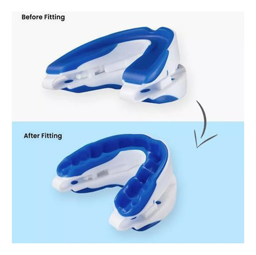 V Home Stopper For Sleep Cuidados De Saúde Bocal Anti Ronco - Imagem 8