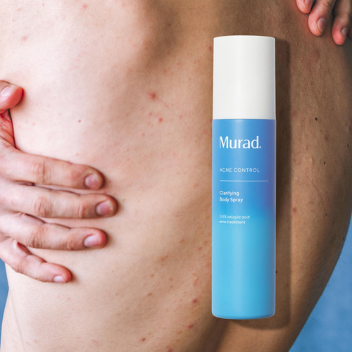 Spray Corporal Murad Clarifying Com Ácido Salicílico 180ml P - Imagem 5