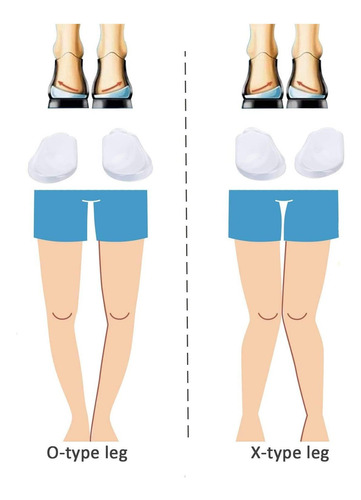 4 Pares De Palmilhas Ortopédicas Para Homens E Mulheres, Da - Imagem 4