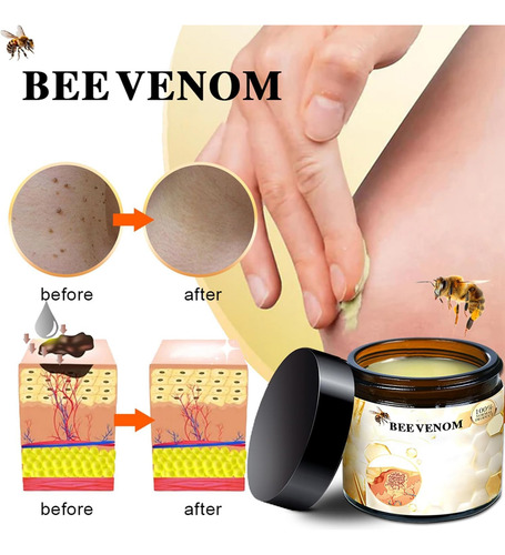 Bee Venom Cream Iekufes New Professional 120ml Para Todo O C - Imagem 2