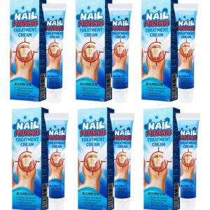 2×creme Unhas Para Onicomicose Pomada Suave Para Junwt