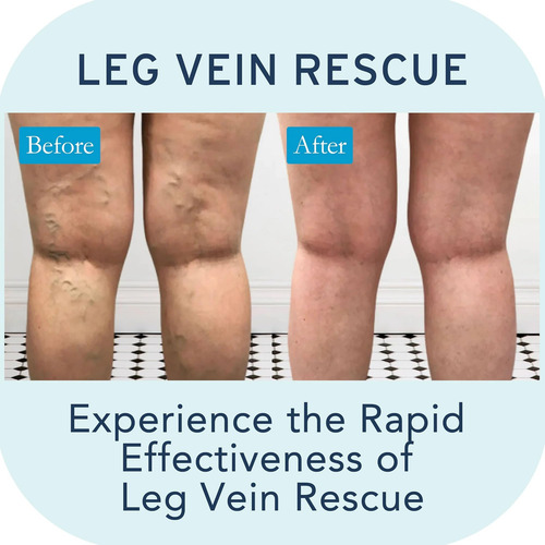 Leg Vein Rescue Suplemento De Saúde Natural De Bioflavonóide - Imagem 5