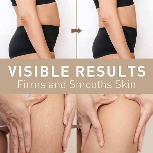 Creme Reafirmante Enaskin Naturals Para Mulheres De Barriga - Imagem 4