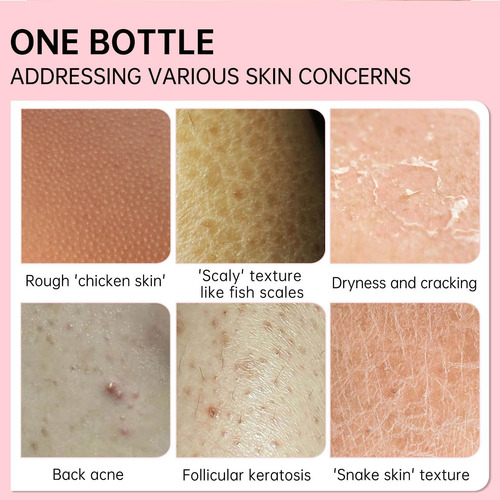 Tratamento De Pernas De Morango Para Mulheres Esfoliante Co - Imagem 2