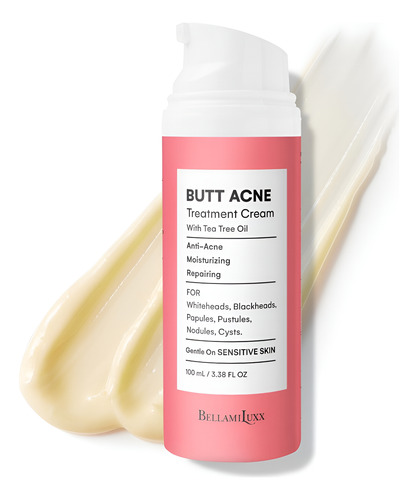 Creme Corporal Para Tratamento De Acne Bellamiluxx