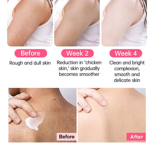 Tratamento De Pernas De Morango Para Mulheres Esfoliante Co - Imagem 4