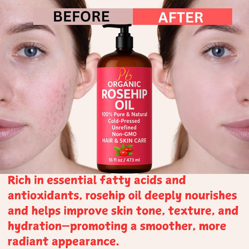 Óleo De Rosa Mosqueta Pomberries 100% Puro E Virgem 16 Oz Ma - Imagem 9