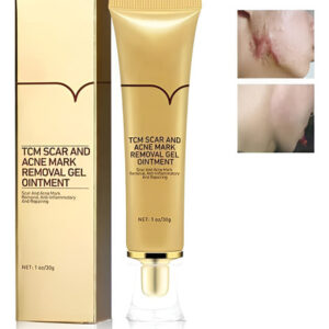 Creme De Extração De Cicatrizes De Acne Akary Uma Marca