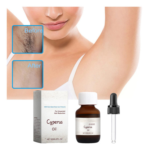Óleo Cyperus Jhked 60 Ml De Cyperus Rotundus Natural Para - Imagem 2