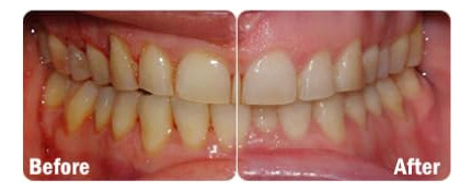 Suplemento Probiótico Probiora Oral-care Em Comprimidos Mast - Imagem 5
