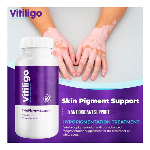 Aura Vitamins - Vitiligo Cápsulas 60 Contagens 1 Mês Mel - Imagem 11
