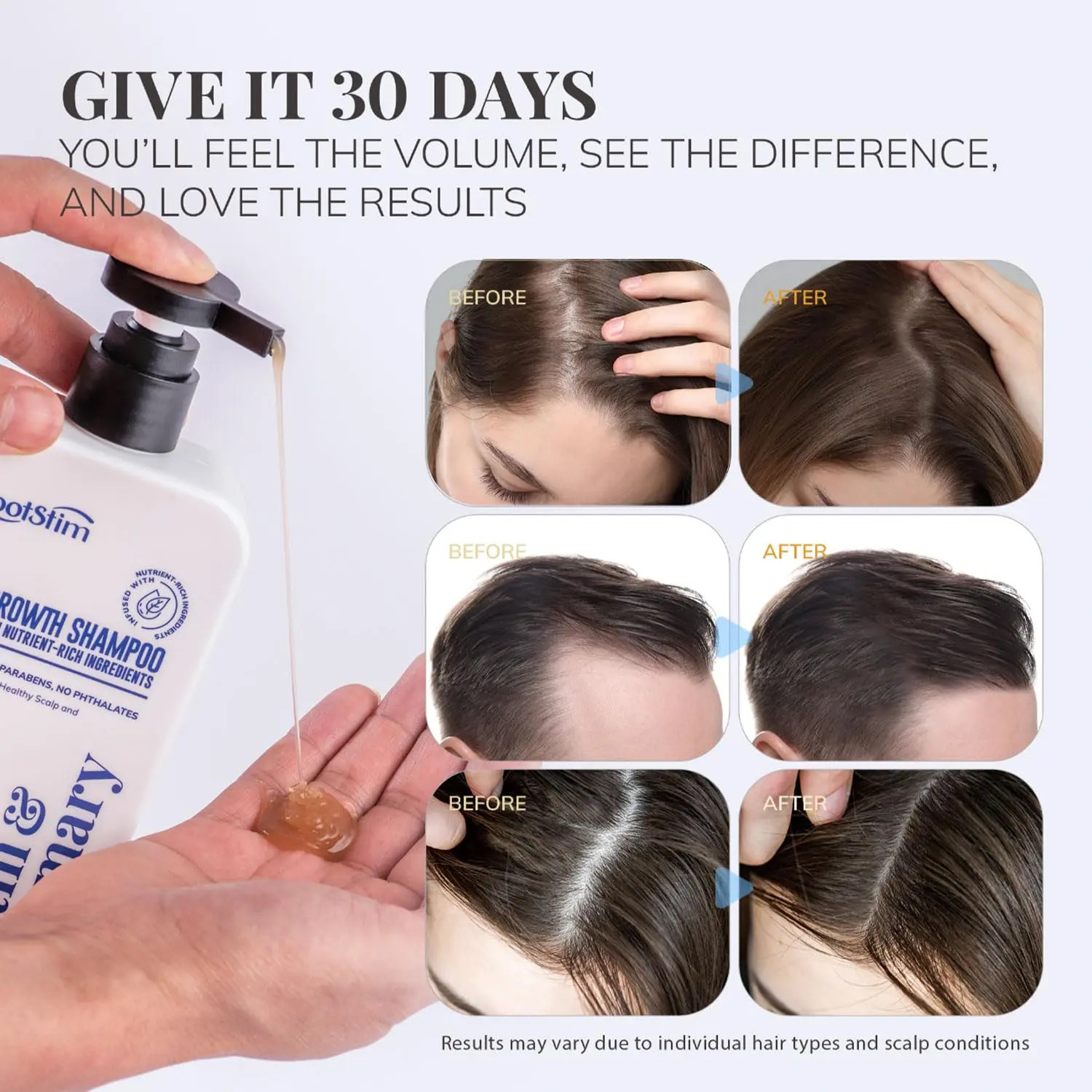 Champô Anticaída Rootstim Biotina Alecrim E Saw Palmetto - Imagem 5